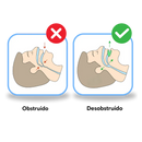 Antironquidos Protector bucal para dormi