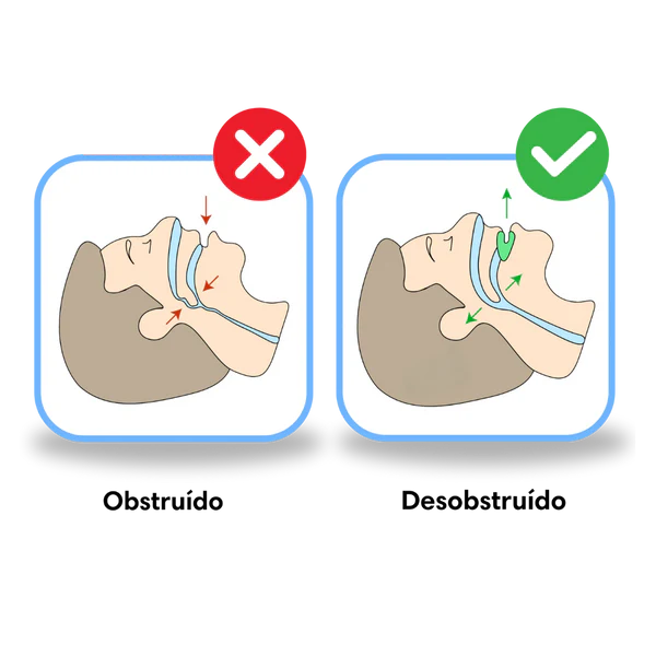 Antironquidos Protector bucal para dormi